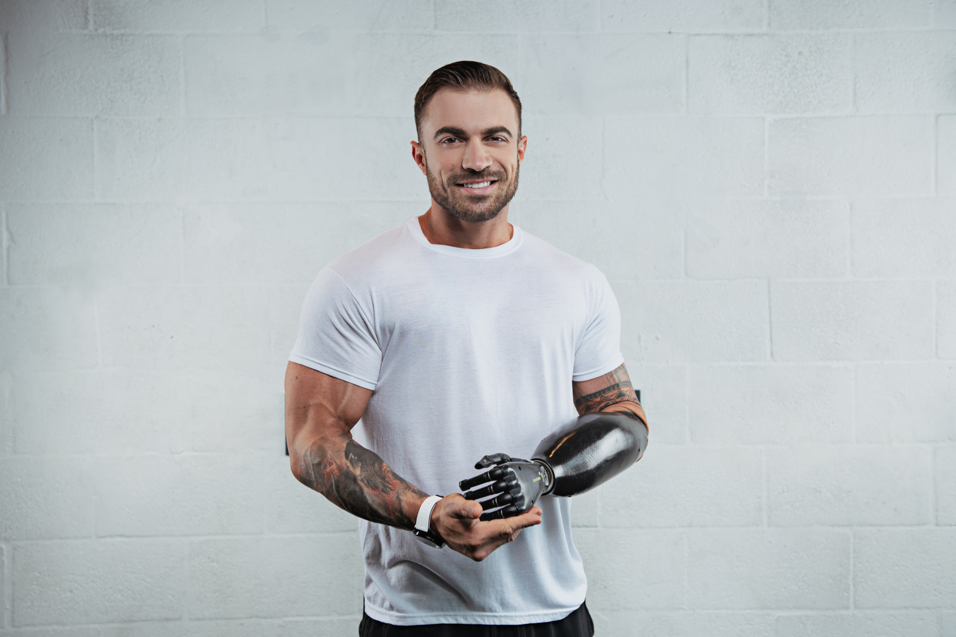 Chris Ruden - Bodybuilder, Powerlifter and One Armed Prosthetic Arm User